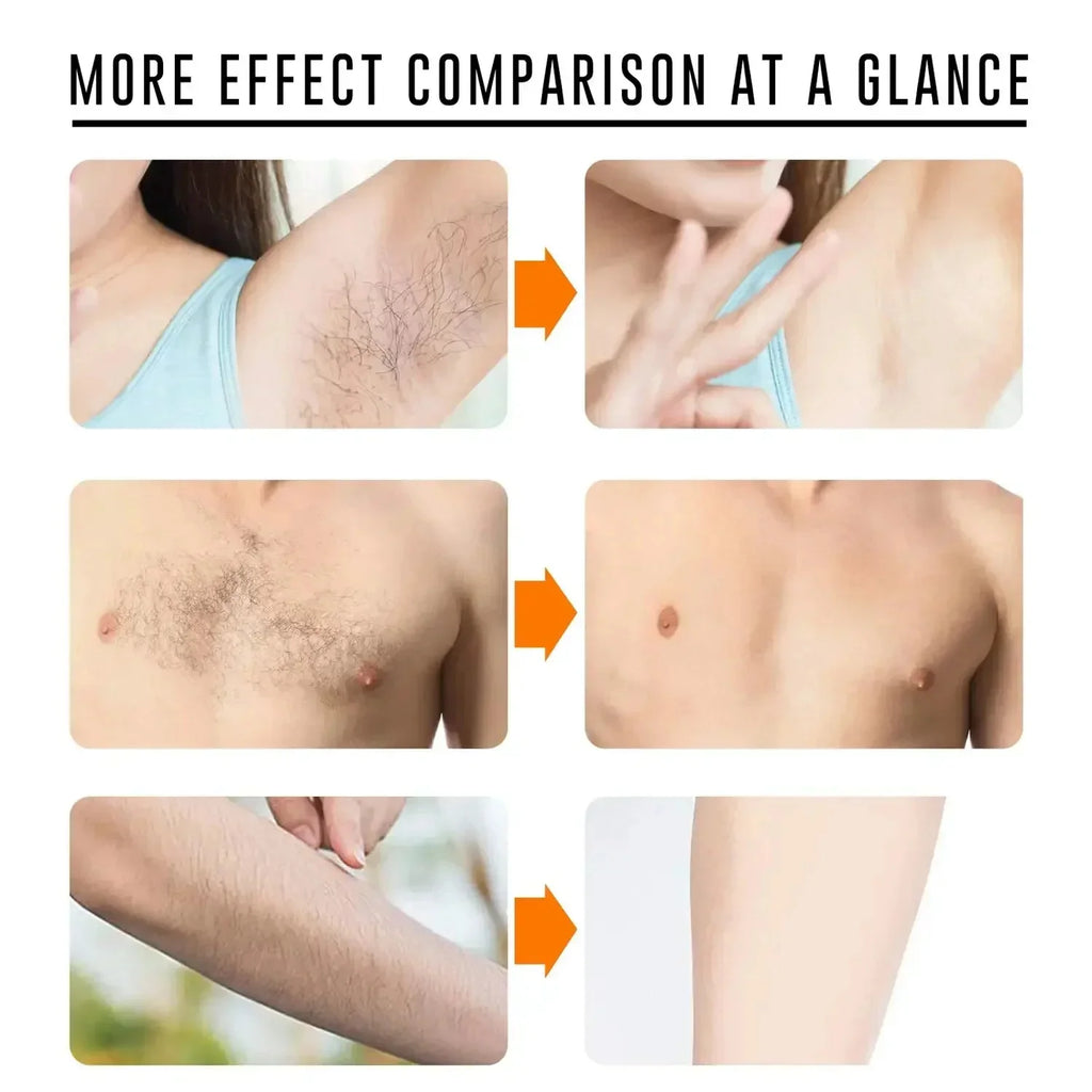 Sakura Hair Removal Cream Fast Painless Hair Growth Inhibitor Arm Armpit Legs Intimate Areas Permanent Depilatory for Men Woman